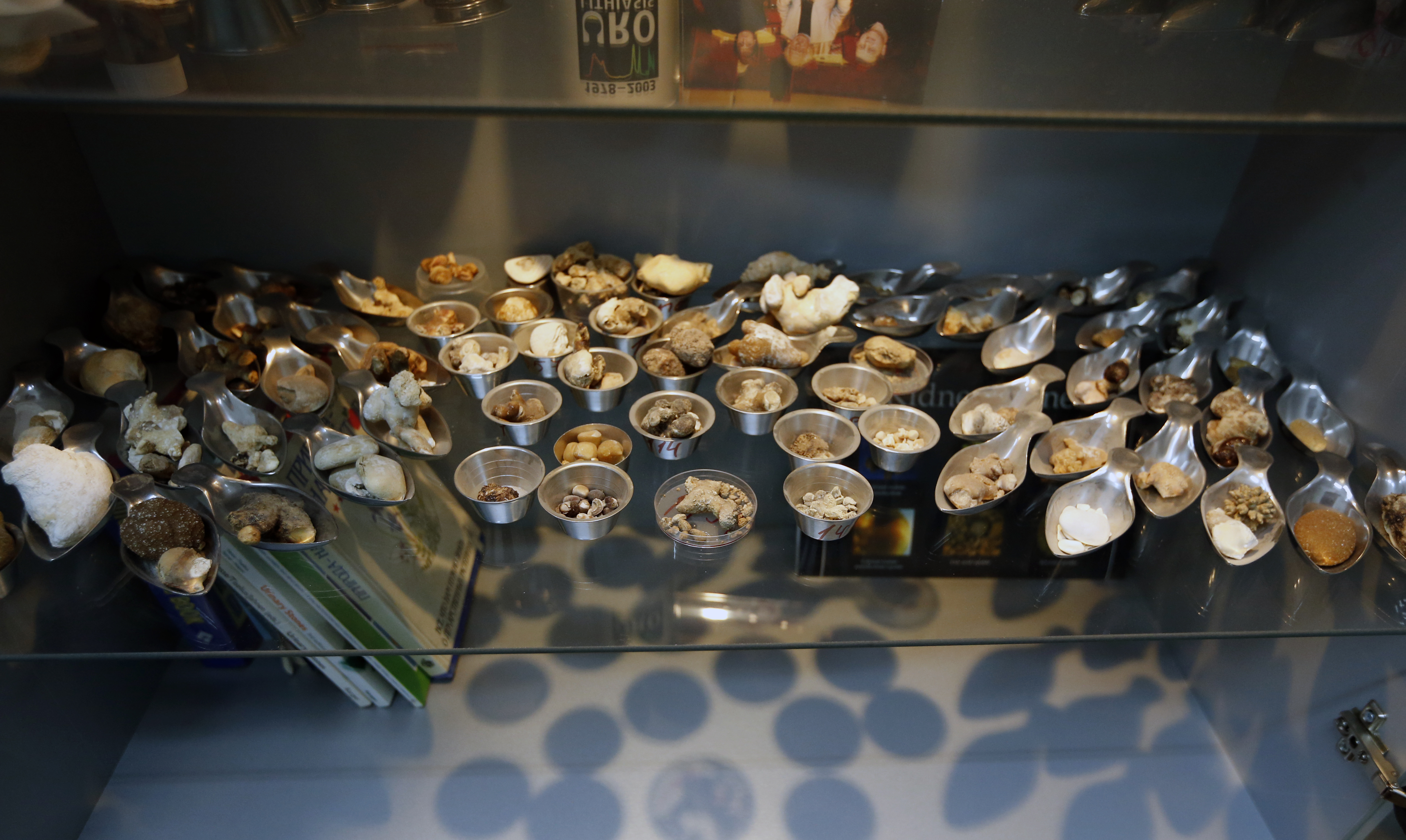 Միզաքարերի լաբորատորիա