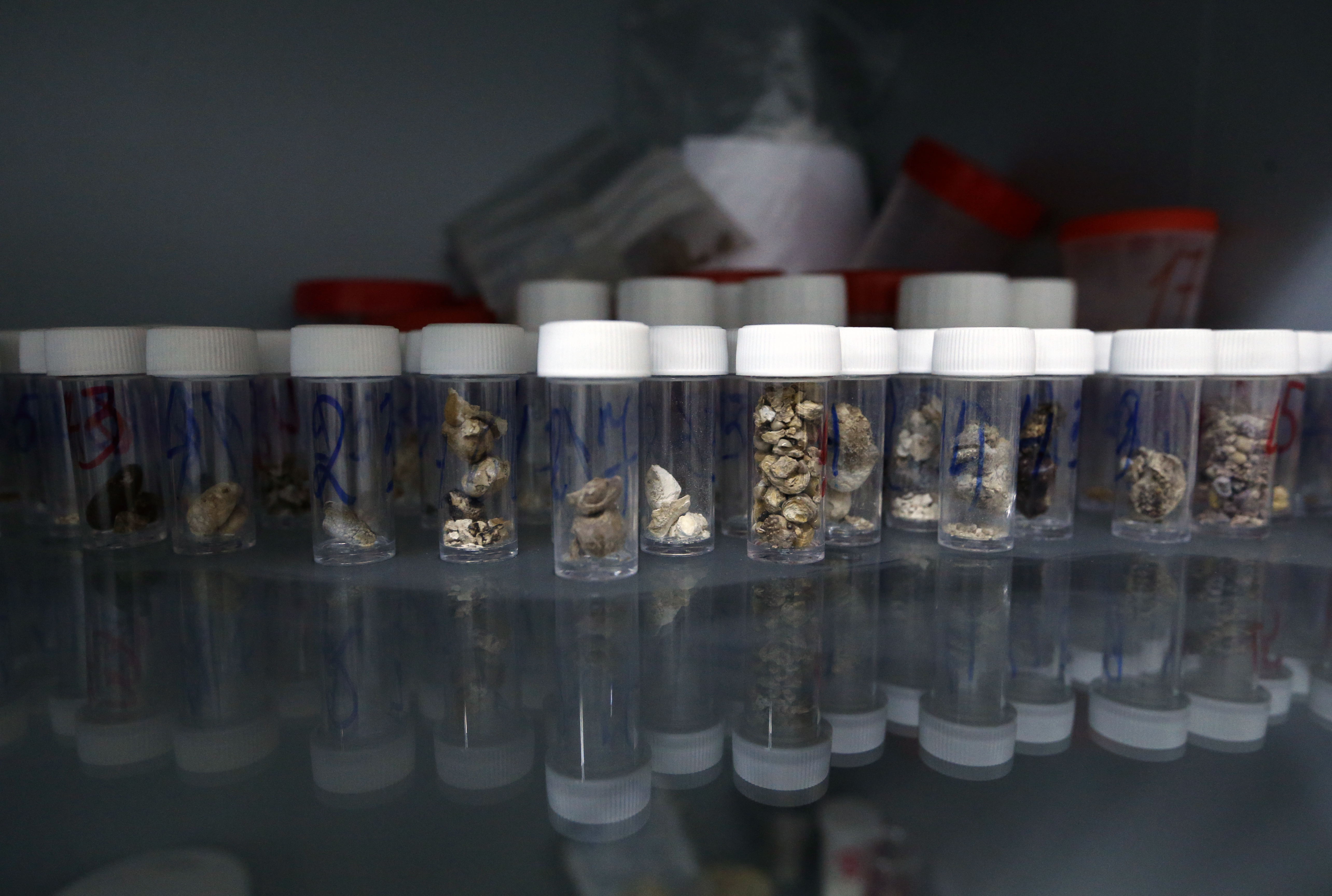 Միզաքարերի լաբորատորիա