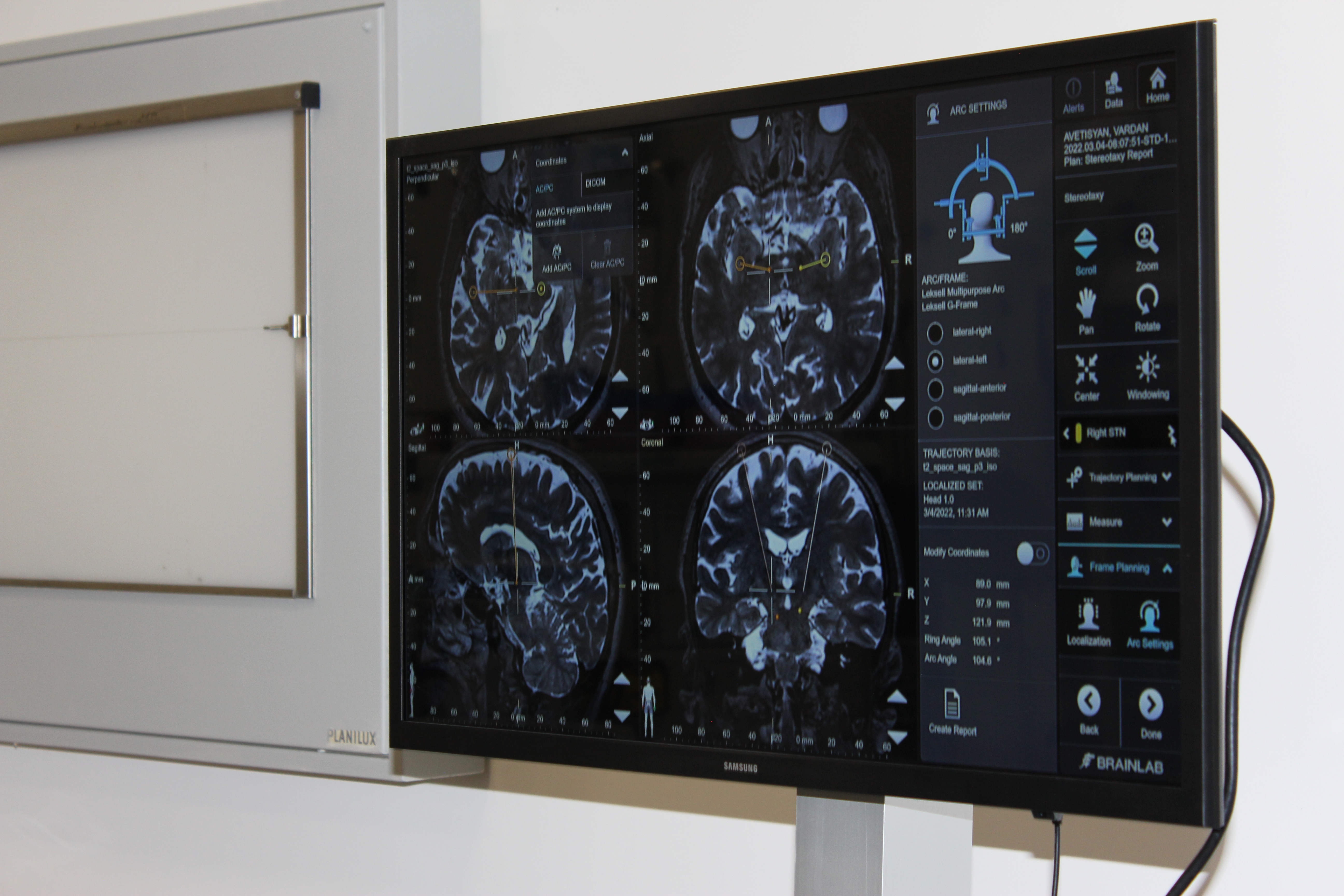 Նյարդաբանական հետազոտություններ