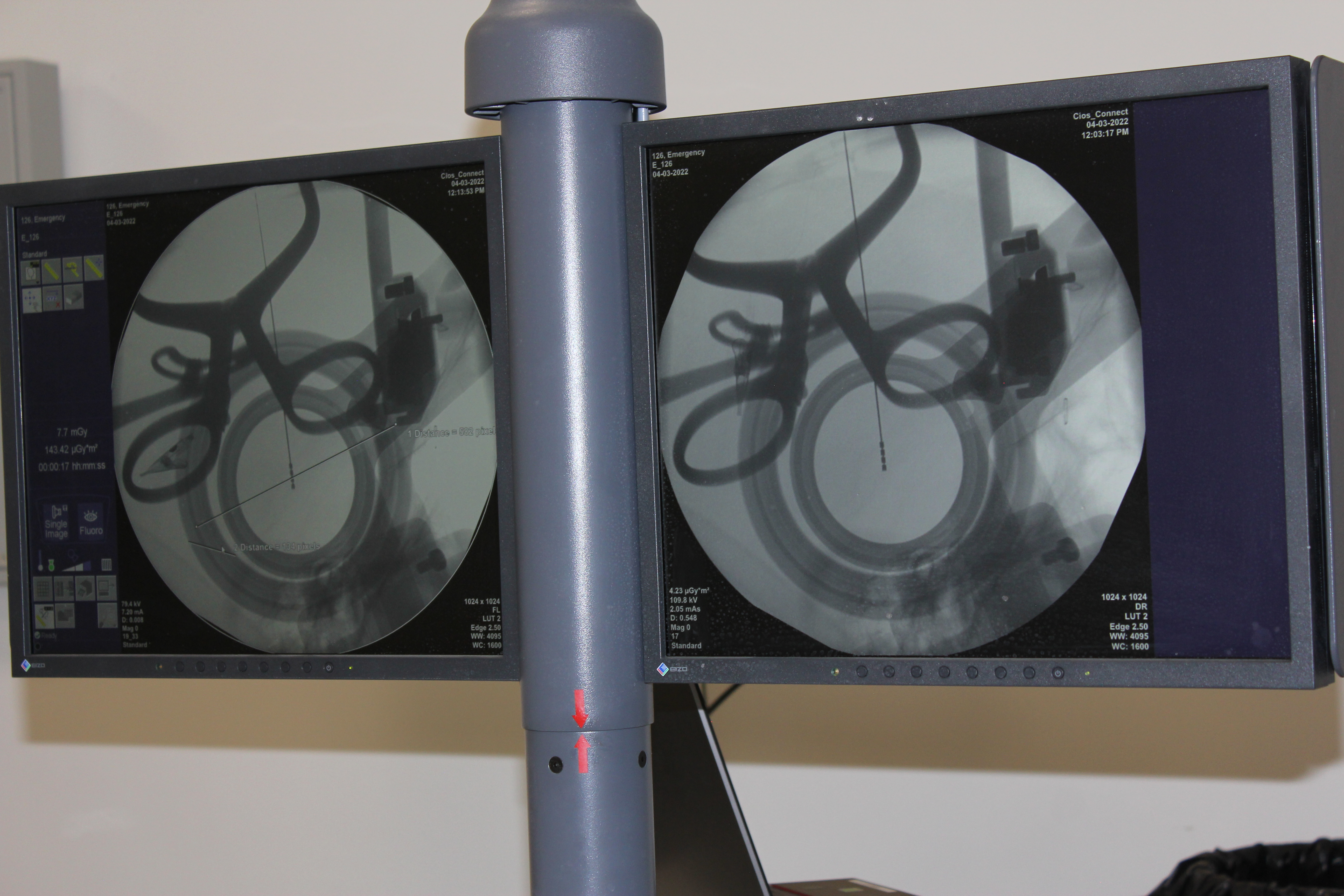 Նյարդաբանական հետազոտություններ